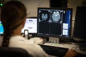 Huntington’s disease treated successfully for first time, doctors say