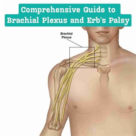 Brachial Plexus - topplasticsurgery