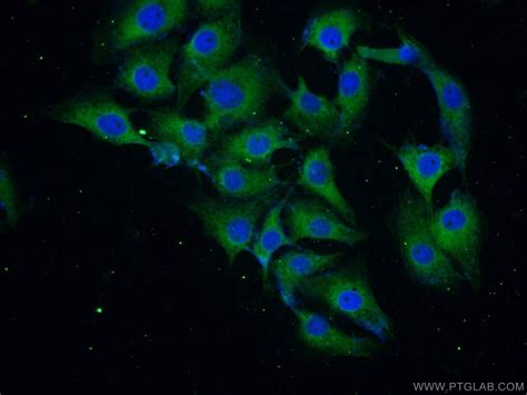 Alpha-Synuclein | Proteintech Group