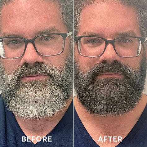 MadisonReed Madison Reed Mr. Hair Color for Men, Dark Brown to India | Ubuy