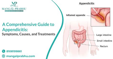 Image result for Appendicitis