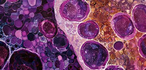 Image result for Learn Patholgy CPT Coding