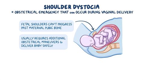 Shoulder Presentation Birth