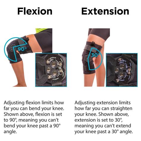 Hinged Knee Brace For Hyperextension at Norma Oscar blog