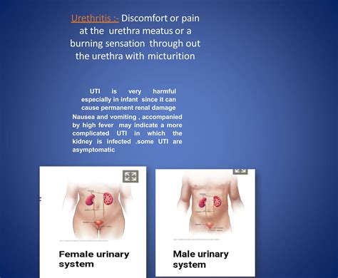 PowerPoint on Urinary Tract Infections(UTI) | PPTX