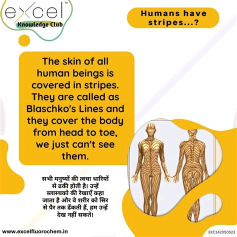 Excel Knowledge Club on LinkedIn: Humans have stripes...?