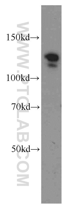ARHGEF1 antibody (11363-1-AP) | Proteintech