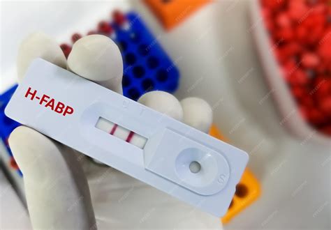 HFP Lab Test 的图像结果