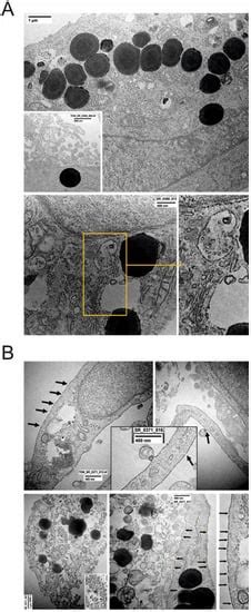 Nicotine in Combination with SARS-CoV-2 Affects Cells Viability ...
