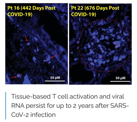 Dr. Patrick Soon-Shiong Highlights COVID-19 Virus Persistence, Finding ...