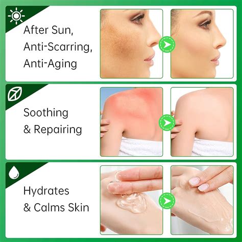 Aloe Vera Moisturizer for Face - Skin Repair, Sunburn Relief | Anti-Scarring & Aging | ECO ...