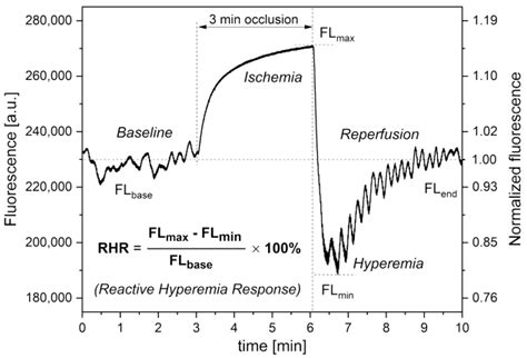 Non-Invasive Assessment of Vascular Circulation Based on Flow Mediated ...