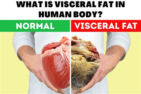 What Is Visceral Fat In Human Body?