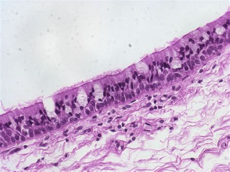 Simple Columnar Epithelium 40x