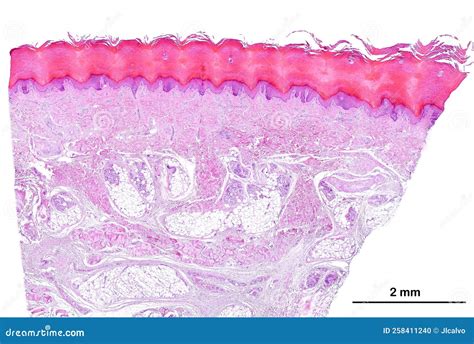 Stratified Squamous Keratinized