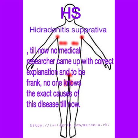 Hidradenitis Supprativa #hidradenitis #hidradenitissuppurativa #acneinversa #skincondition # ...
