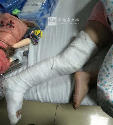 5岁女童遭继母哥哥虐待 9根肋骨骨折[1]- 中国日报网