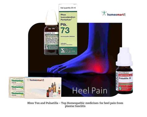 Heel Pain and Calcaneal Spur Homeopathic Remedies | Instant Relief ...