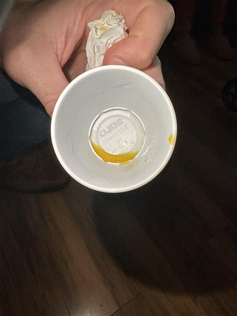 Fluid Pouring Out Of Nose at Makayla Hampton blog