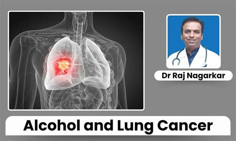 Excessive Alcohol Consumption: Hidden Risk Factor for Lung Cancer ...
