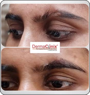DermaClinix | Eye Lash/Brow Beautification