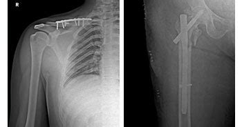 Orthopedics Treatments,Trauma Care Treatments | Neuro & Plastic Surgery