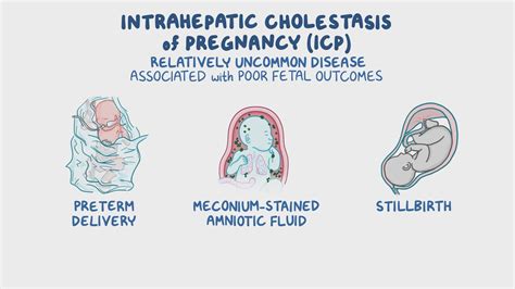 When Does Cholestasis Happen In Pregnancy