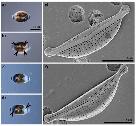 Lipid Constituents of Diatoms (Halamphora) as Components for Production ...