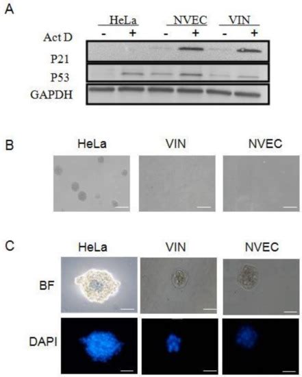 The First Human Vulvar Intraepithelial Neoplasia Cell Line with ...