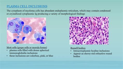 PLASMA CELL DYSCRASIAS Overview.....pptx