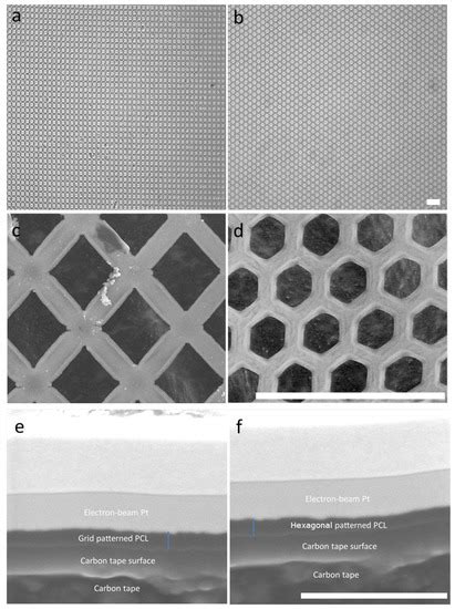 Recreating the Trabecular Outflow Tissue on Implantable, Micropatterned ...