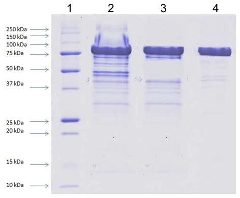 A New Expression System Based on Psychrotolerant Debaryomyces ...
