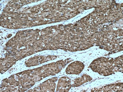 ASC/TMS1 antibody (10500-1-AP) | Proteintech