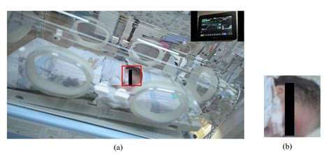 Non-Contact Automatic Vital Signs Monitoring of Infants in a Neonatal ...