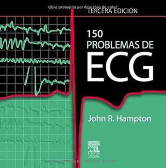 Buy 150 Problems de ECG Book Online at Low Prices in India | 150 ...