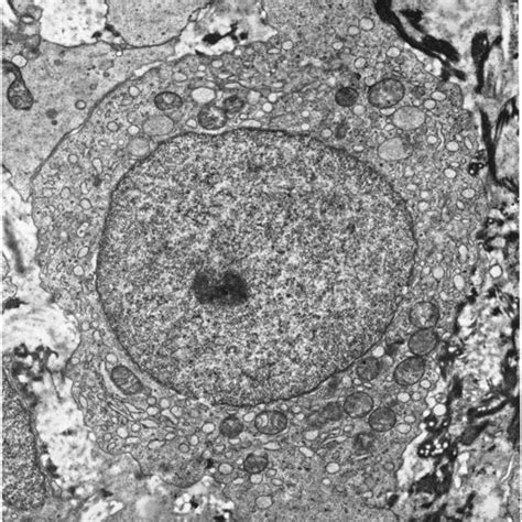 Image result for Monocyte Under Microscope