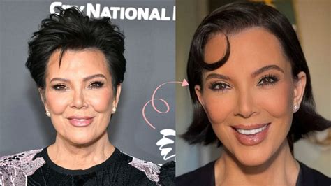 Kris Jenner Face Surgery