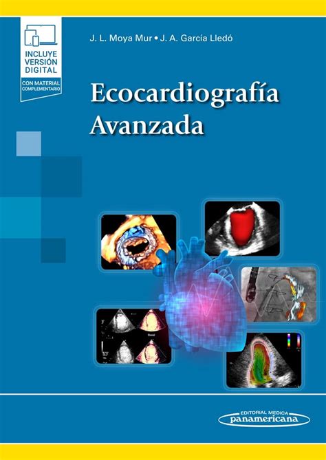 Buy Ecocardiografía Avanzada + e-book (Spanish Edition) Book Online at ...