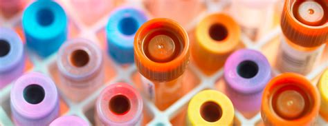 Image result for WBC Count Microscope