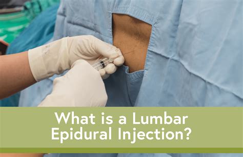 Image result for Epidural Injection Procedure