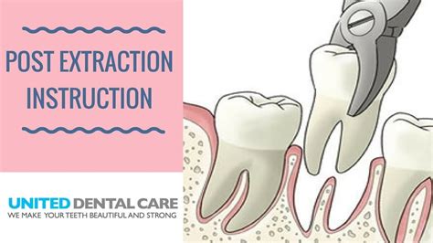 Post-Extraction Instructions Template 的图像结果