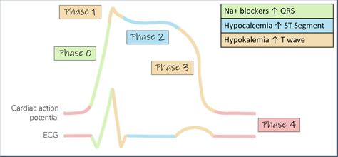 JUCM: ECG Challenge #4 | ECG Stampede