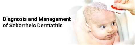 Diagnosis and Management of Seborrheic Dermatitis