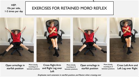 Retained Landau Reflex With Images Primitive Reflexes Primitive