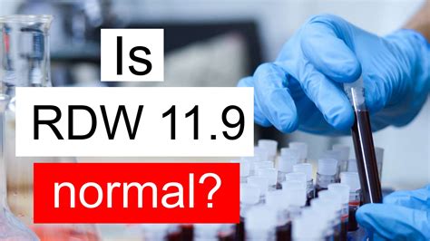 Is RDW 11.9 normal, high or low? What does Red cell distribution width level 11.9 mean?