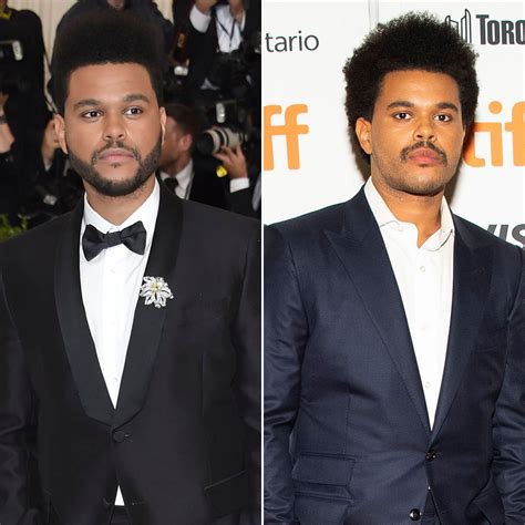47 Best The Weeknd Plastic Surgery Photos