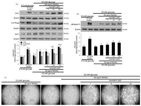 Coumarin Ameliorates Impaired Bone Turnover by Inhibiting the Formation ...