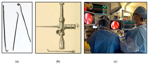 The Current State of Visualization Techniques in Endoscopic Skull Base ...