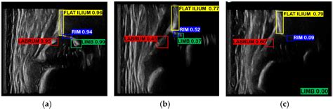 Development of a Fully Automated Graf Standard Plane and Angle ...