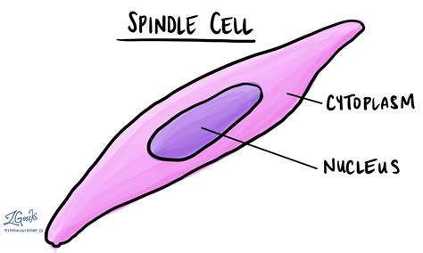 Spindle cell neoplasm | MyPathologyReport.ca